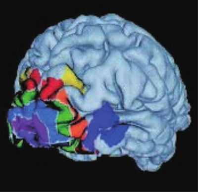 視覚の脳地図